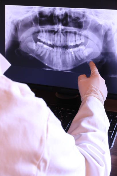 Best Dentist for Tooth Abscess  in Lucerne, CA