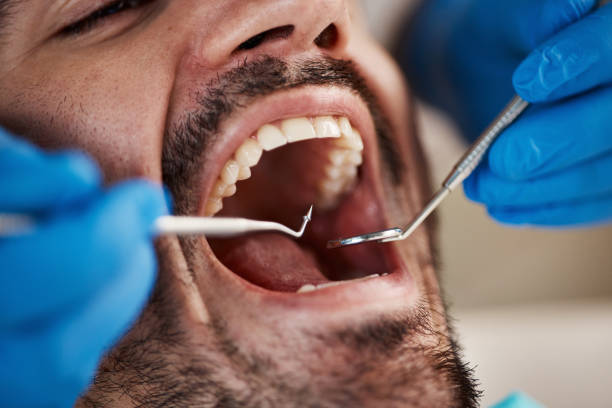 Best Emergency Gum Pain Relief  in Lucerne, CA